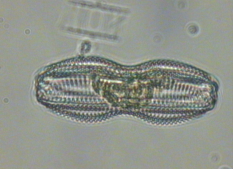 Dictyocha speculum